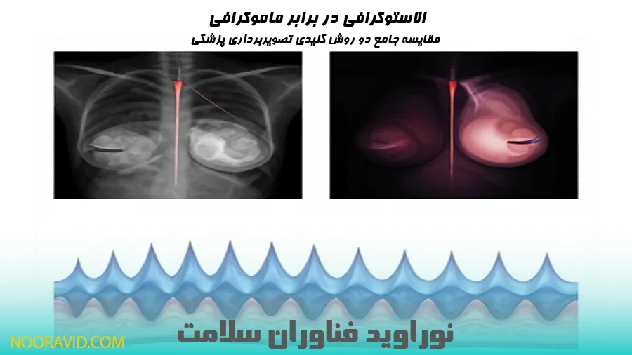 تفاوتهای کلیدی الاستوگرافی و ماموگرافی؛ از اصول فیزیکی و کاربردها تا مزایا و معایب