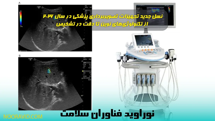 تجهیزات تصویربرداری پزشکی الاستوگرافی