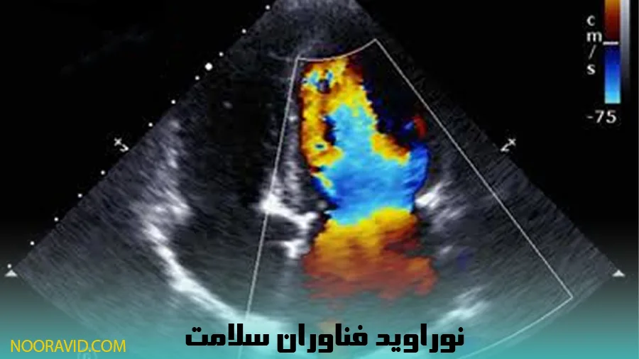 کاربردهای متنوع الاستوگرافی در بدن
