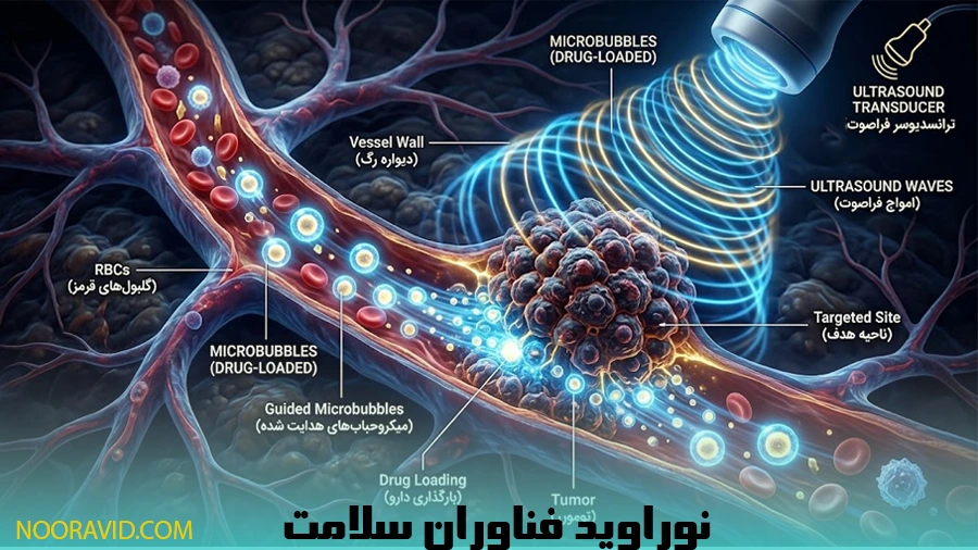 تاثیر امواج فراصوت بر روی دارورسانی بر تومورهای سرطانی